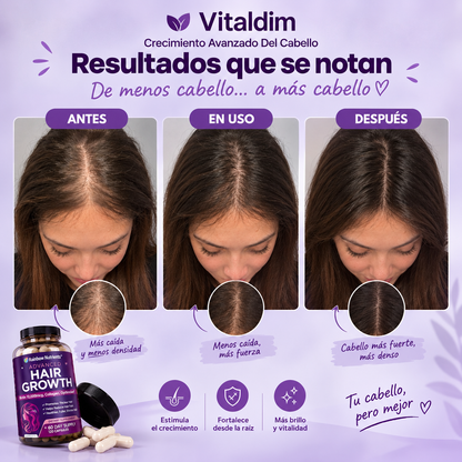 Vitaminas para el Crecimiento del Cabello