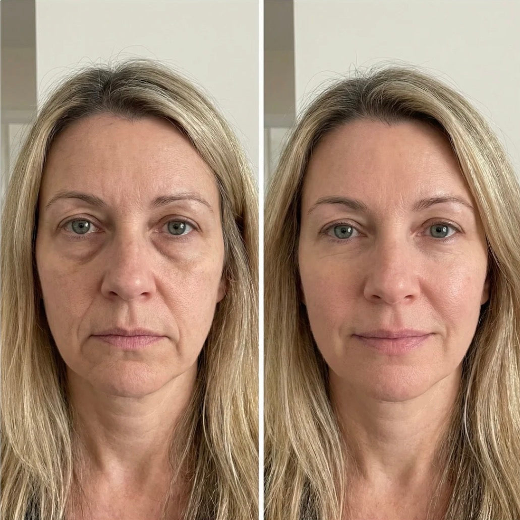 Vitaldim™ - Cepillo de masaje Linfático facial