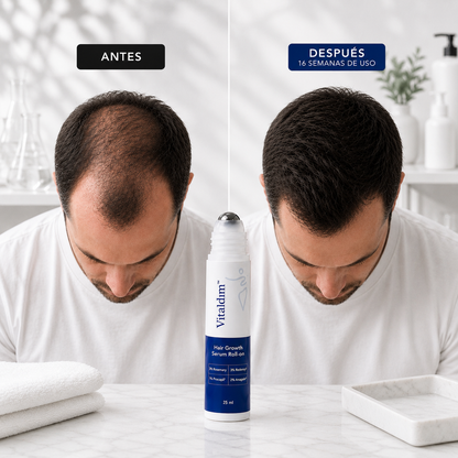 Serum Crecimiento Capilar Vitaldim™